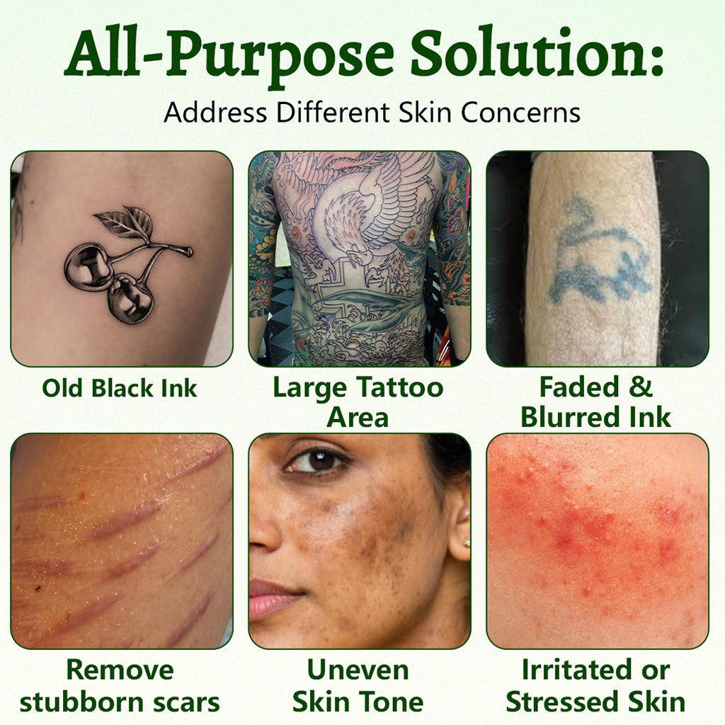 🚀CureVivo® PureAlgae Ink Removal Support Spray 🌿 — Say Goodbye to Old Tattoo Pigment 💚, Fade Stubborn Ink ✨, Repair & Smooth Treated Skin 💧, Non-Laser ✅, Try It Now! 🔥