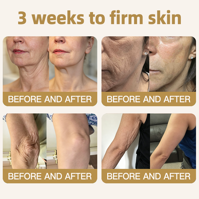 🔥 80%OFF — FINAL 3 HOURS🔥Turonu® Botox Bee Venom Microneedle Firming Patch (Bat Wings,Stretch Marks,Wrinkles & Cellulite — Just 10 Minutes a Day,Visible Results in 7 Days.)