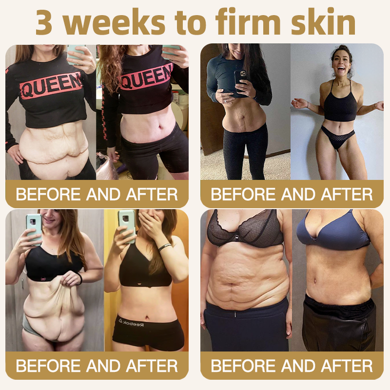 🔥 80%OFF — FINAL 3 HOURS🔥Turonu® Botox Bee Venom Microneedle Firming Patch (Bat Wings,Stretch Marks,Wrinkles & Cellulite — Just 10 Minutes a Day,Visible Results in 7 Days.)