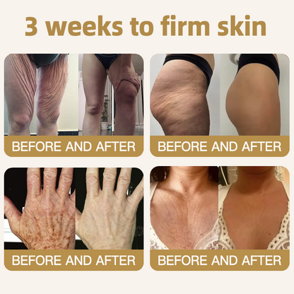 🔥 80%OFF — FINAL 3 HOURS🔥Turonu® Botox Bee Venom Microneedle Firming Patch (Bat Wings,Stretch Marks,Wrinkles & Cellulite — Just 10 Minutes a Day,Visible Results in 7 Days.)