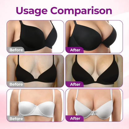 💥Turonu® 🦪Targeted Breast Enhancement Advanced Nano Microneedle Patch💃