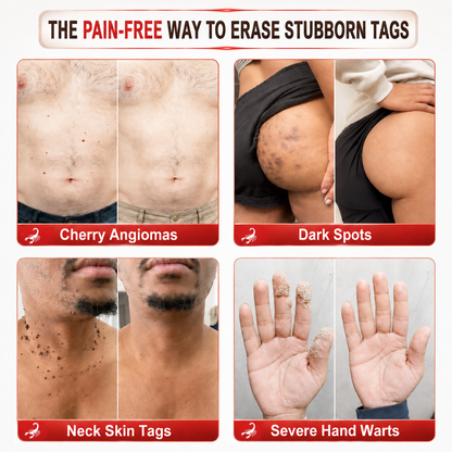 👨‍⚕️🔥𝗖𝘂𝗿𝗲𝗩𝗶𝘃𝗼® Add a second item and enjoy 45% off!