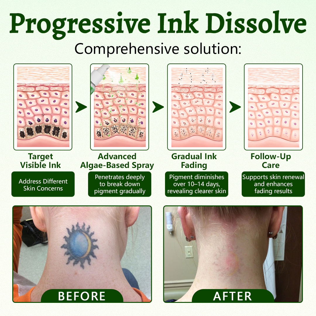🚀CureVivo® PureAlgae Ink Removal Support Spray 🌿 — Say Goodbye to Old Tattoo Pigment 💚, Fade Stubborn Ink ✨, Repair & Smooth Treated Skin 💧, Non-Laser ✅, Try It Now! 🔥