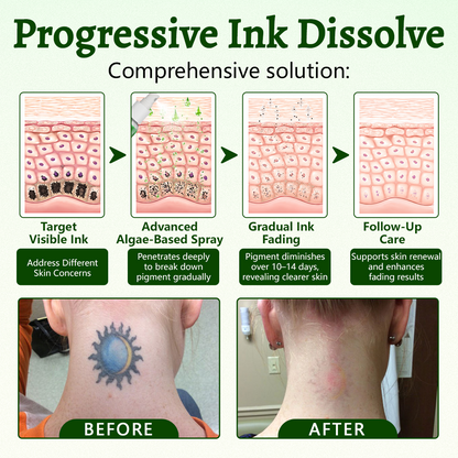 🚀CureVivo® PureAlgae Ink Removal Support Spray 🌿 — Say Goodbye to Old Tattoo Pigment 💚, Fade Stubborn Ink ✨, Repair & Smooth Treated Skin 💧, Non-Laser ✅, Try It Now! 🔥