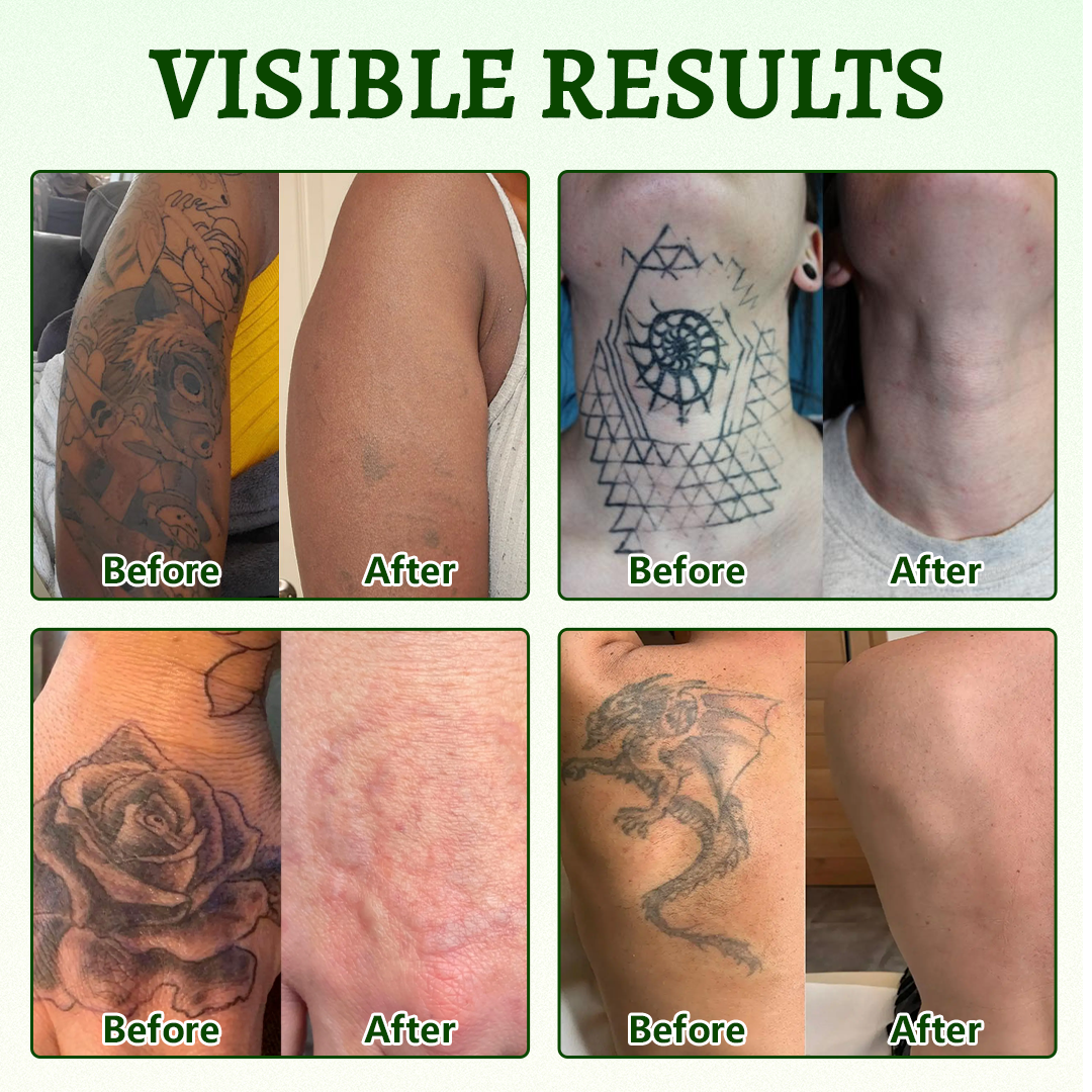 🚀CureVivo® PureAlgae Ink Removal Support Spray 🌿 — Say Goodbye to Old Tattoo Pigment 💚, Fade Stubborn Ink ✨, Repair & Smooth Treated Skin 💧, Non-Laser ✅, Try It Now! 🔥