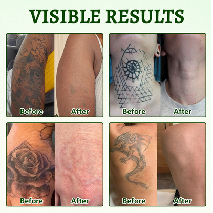 🚀CureVivo® PureAlgae Ink Removal Support Spray 🌿 — Say Goodbye to Old Tattoo Pigment 💚, Fade Stubborn Ink ✨, Repair & Smooth Treated Skin 💧, Non-Laser ✅, Try It Now! 🔥